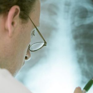 Aprende sobre diferentes patologías relacionadas con los pulmones, identíficando síntomas y tratamientos que te ayudarán a controlar la enfermedad.